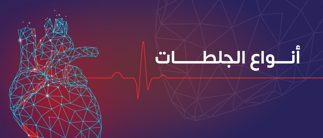 heart-attack-types-image